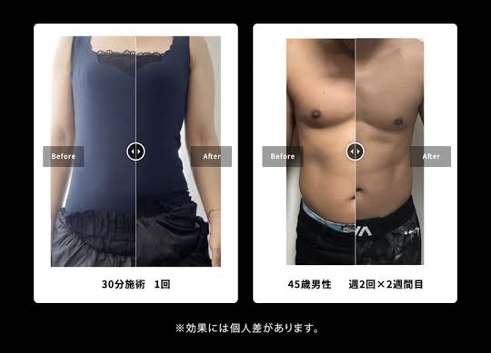 3-トランスビート